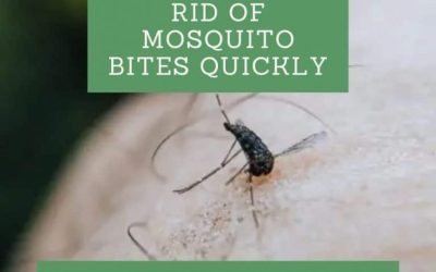 How to Get Rid of Mosquito Bites Quickly